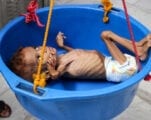جيلٌ ضائع من الأطفال في اليمن